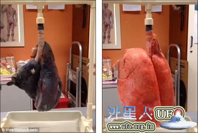 实验表明吸烟者的肺“且黑且干瘪”
