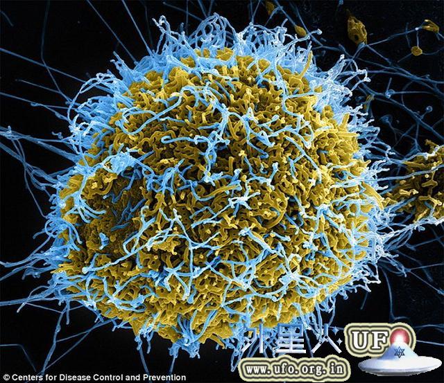 科学家发现埃博拉病毒0.23亿年前“祖先”