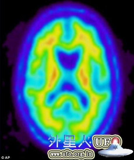 随着恒星塌缩过程的进行，其内部开始快速合成重元素，如氧，氖，镁和硅。这一过程会释放大量能量，它最终将逆转塌缩进程，并引发超新星爆发 第2张