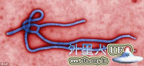 埃博拉病毒。埃博拉病毒于1976年发现，属纤丝病毒科。美国波士顿大学的科学家研发了一种全新的传感器，能够在短短30分钟内完成对血样的检测，确定患者是否感染埃博拉病毒。专家们表示采用这种传感器的检测装置尺寸与鞋盒差不多，任何人都可以操作，可以运到非洲帮助监控埃博拉病毒的蔓延。 第1张
